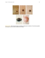 MISSING THUMBNAIL