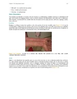 MISSING THUMBNAIL