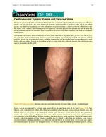 MISSING THUMBNAIL
