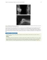 MISSING THUMBNAIL