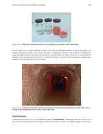 MISSING THUMBNAIL