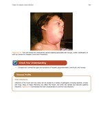 MISSING THUMBNAIL